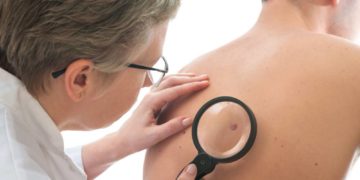 Krebsfrüherkennung: „Chance der frühen Diagnostik besser nutzen“