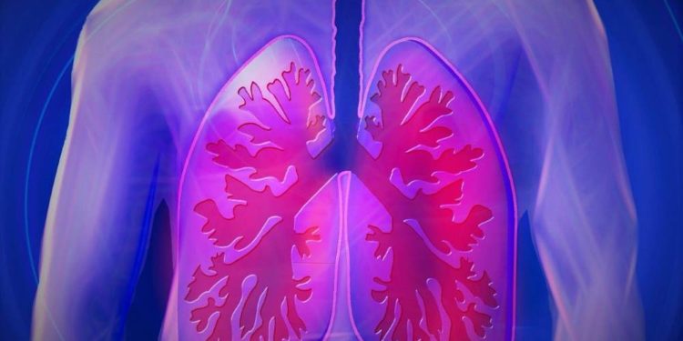 „Think TB“ – Fortbildungsveranstaltung zum Thema Tuberkulose