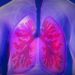 „Think TB“ – Fortbildungsveranstaltung zum Thema Tuberkulose
