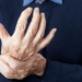 Gelenkschmerzen für 2.500 an rheumatoider Arthritis Erkrankte im Kreis